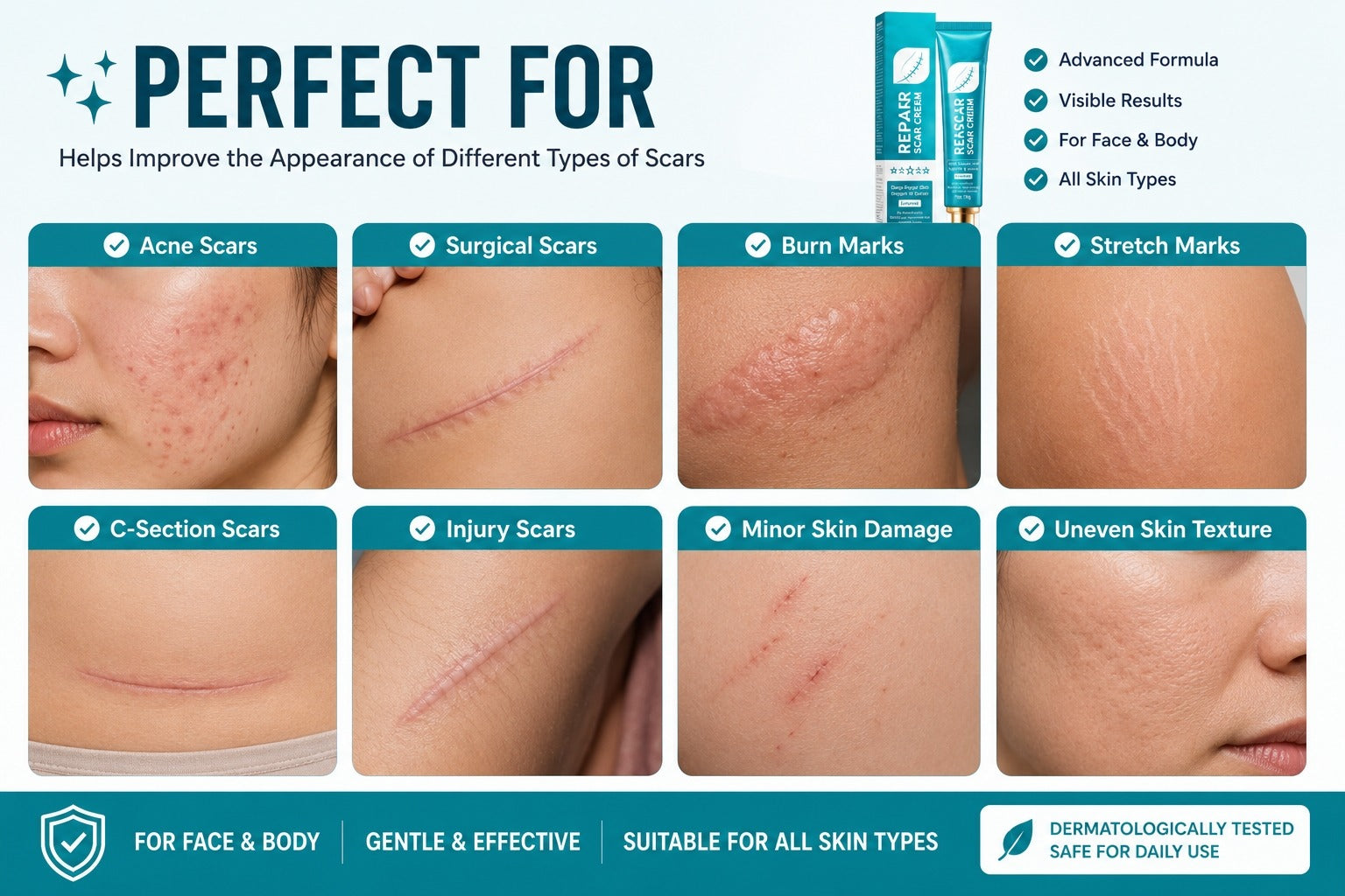 Scar types suitable for Advanced Scar Repair Cream